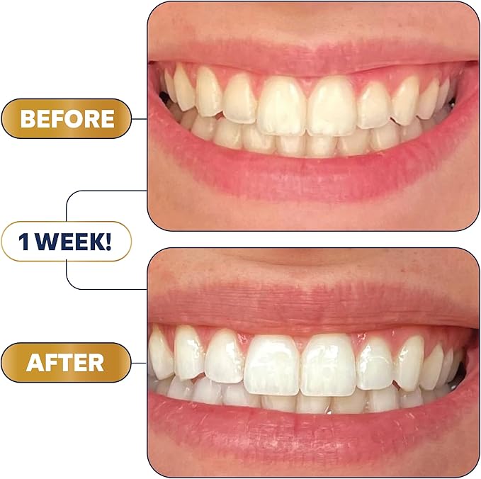 Lumineux Teeth Whitening Strips - 21 Treatments (3 Months) - Peroxide Free - Enamel Safe for Whiter Teeth - Whitening Without The Sensitivity - Dentist Formulated - Sensitivity